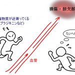 痛みを味方につける